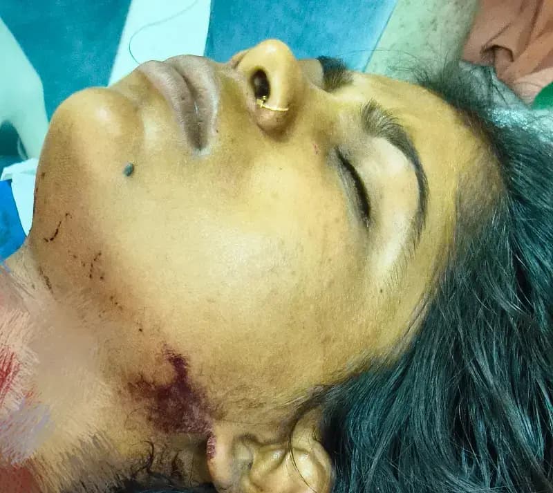 नहाने को कहा तो भड़क उठा पति, चाकू से पत्नी का गला रेता : 10 से ज्यादा टांके लगे